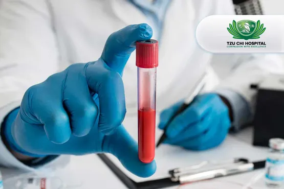 Tes PSA (Prostat Specific Antigen)