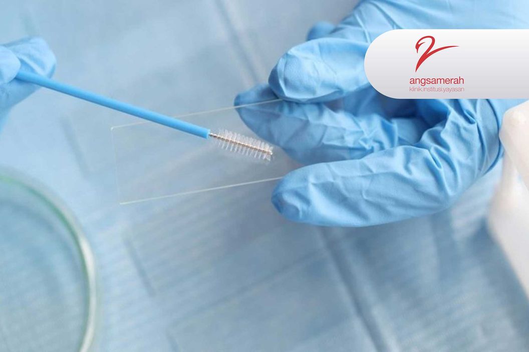 https://img-kd.kalbe.co.id/-Ic5QnUgm_piuQHE7jdyKMx9Kz4=/fit-in/1056x705/filters:quality(90)/oneonco-prd/product%2Fanal-papsmear-angsamerah_1679901510.jpg