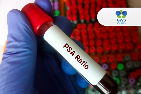 Analisis Rasio Free PSA / Total PSA