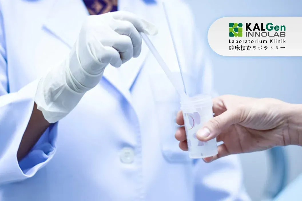https://img-kd.kalbe.co.id/4zNrqxhYET_ekc8L7afaLJ9NK1Y=/fit-in/1056x705/filters:quality(90)/oneonco-prd/product/hpv-dna-test-kalgen__1782110407.webp