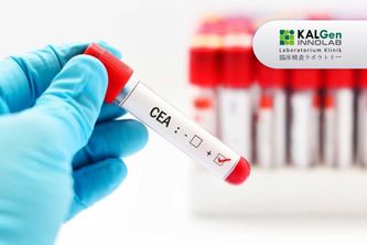 CEA - Tumor Marker