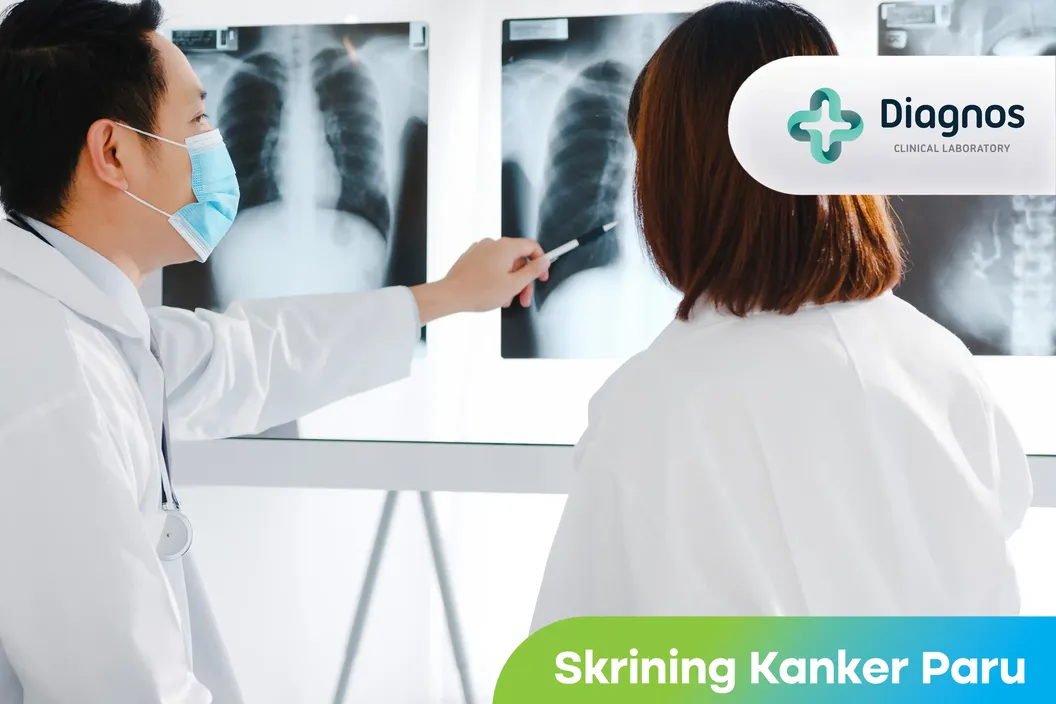 https://img-kd.kalbe.co.id/BbymyaNjzfMQi6EcARRy-Irxakg=/fit-in/1056x705/filters:quality(90)/oneonco-prd/product/Laboratorium%20Diagnos%20-%20Skrining%20Kanker%20Paru_1758876568.webp