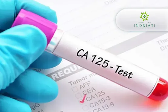 Ca-125 (Cancer Antigen)