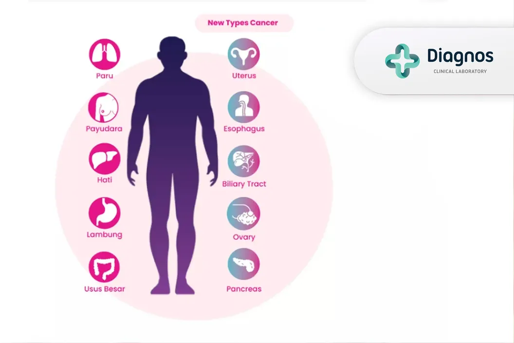 https://img-kd.kalbe.co.id/G3Ncq2v459ayQVNYxQJqStq9QxA=/fit-in/1056x705/filters:quality(90)/oneonco-prd/product/Diagnos%20-%20SPOTMAS10_1762833603.webp