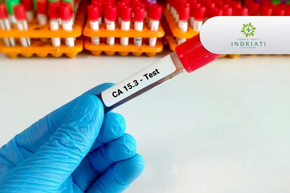 https://img-kd.kalbe.co.id/J0q5uEF3LcaejYLk44z-XLOz-AA=/fit-in/1056x705/filters:quality(90)/oneonco-prd/product/CA-15-3-INDRIATI-SOLO_1672391375.jpg