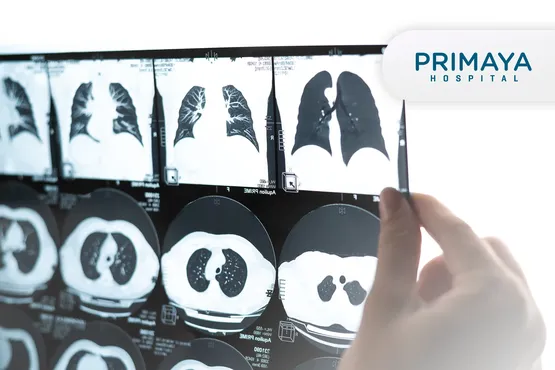 CT Scan Thorax (Lung - Mediastinum)
