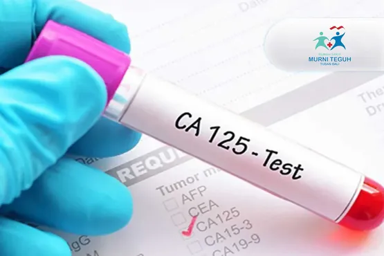 CA-125