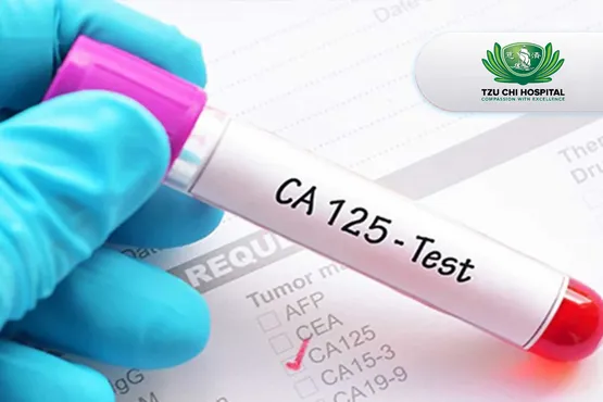 CA-125