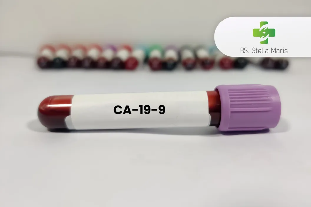 https://img-kd.kalbe.co.id/QfOqhooZPcd236jKveM_-00meOw=/fit-in/1056x705/filters:quality(90)/oneonco-prd/product/RS%20Stella%20Maris%20-%20CA-19-9_1746516439.webp