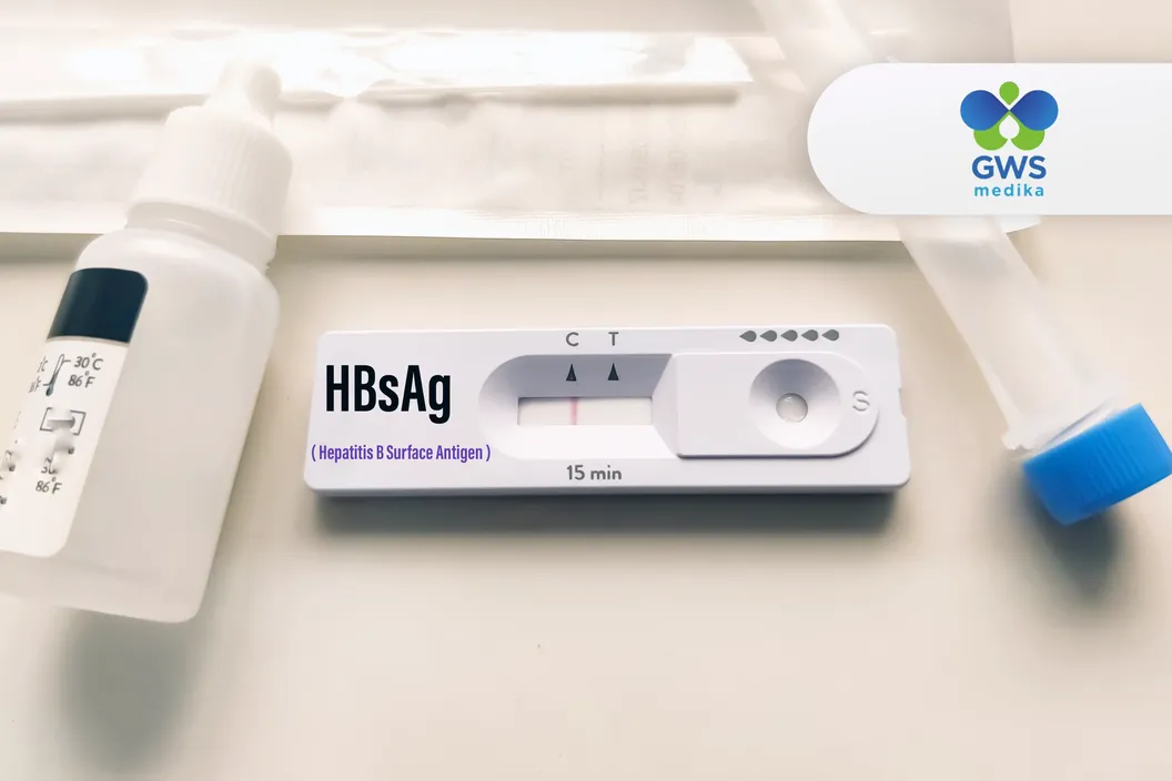 https://img-kd.kalbe.co.id/SzTmus7rt_accdYjUA4RlHsMLvs=/fit-in/1056x705/filters:quality(90)/oneonco-prd/product/Klinik%20GWS%20Medika%20-%20HBsAg%20Test_1754878691.webp