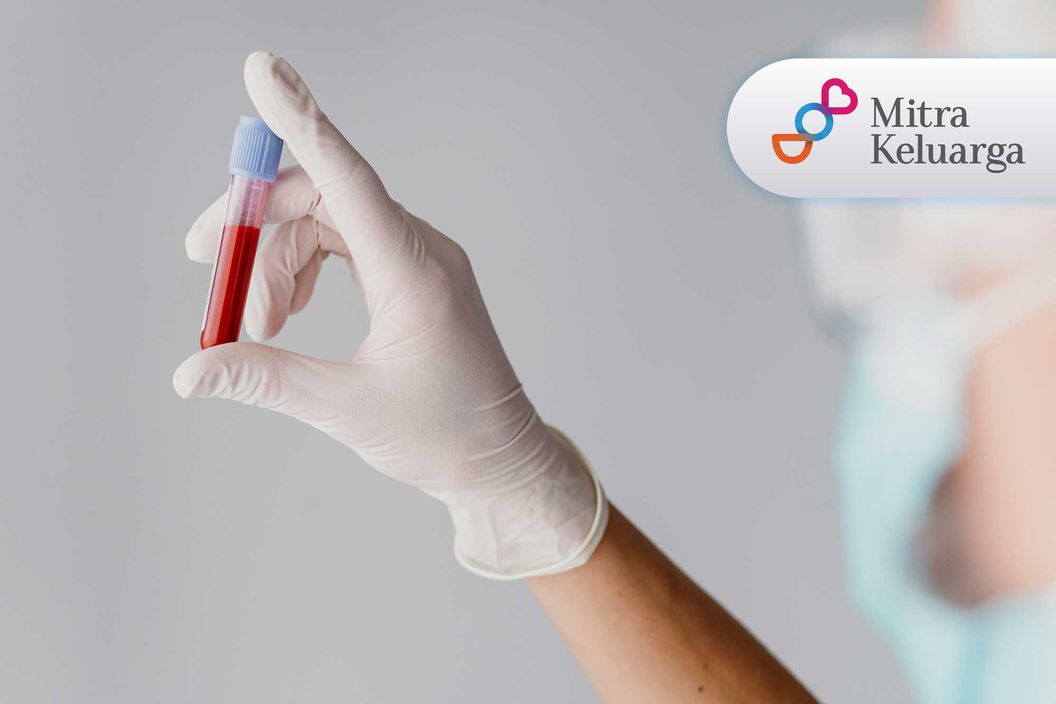 https://img-kd.kalbe.co.id/TxvsvzdNUb7CTq4izgwT3GFdI08=/fit-in/1056x705/filters:quality(90)/oneonco-prd/product/FOBT-Test-darah-samar-mitra_1683001800.jpg