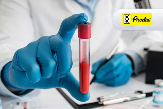 Tes PSA (Prostat Specific Antigen)