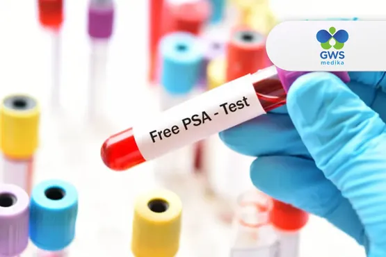 Tes Free PSA - Indikator Risiko Prostat