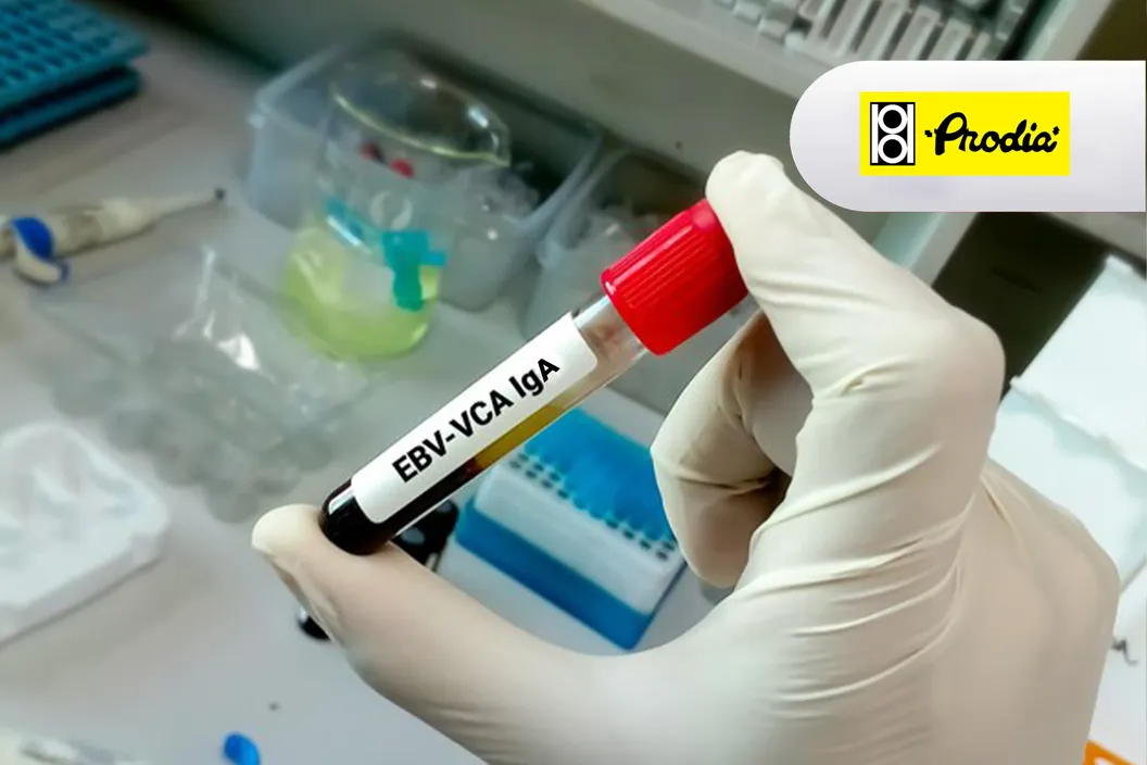 https://img-kd.kalbe.co.id/Wytt6mOqC7vjKf6UcYiBpyA1Uug=/fit-in/1056x705/filters:quality(90)/oneonco-prd/product/Prodia-Epstein-Barr%20Virus%20Viral%20Capsid%20Antigen%20%28VCA%29%20Antibody%20%28IgA%29_1722909093.webp