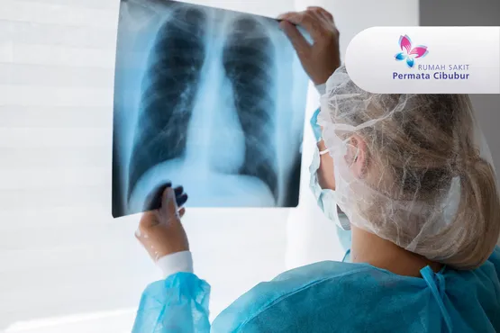 CT Scan Thorax Low Dose