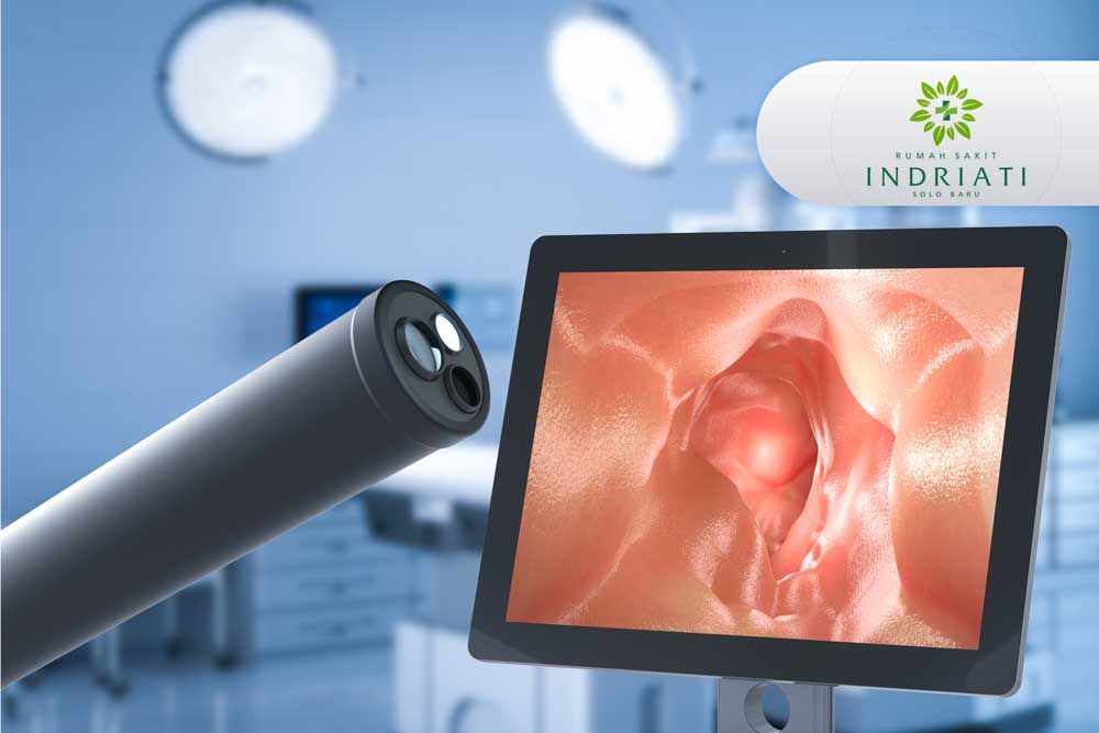 https://img-kd.kalbe.co.id/Zm8kn96Lqit8ZZlVXfH2kZzHhQ0=/fit-in/1056x705/filters:quality(90)/oneonco-prd/product/kolonoskopI-INDRIATI_1672393765.jpg