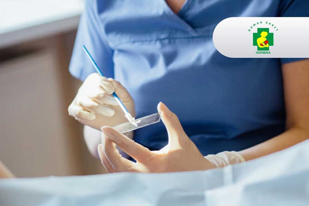 Pap Smear