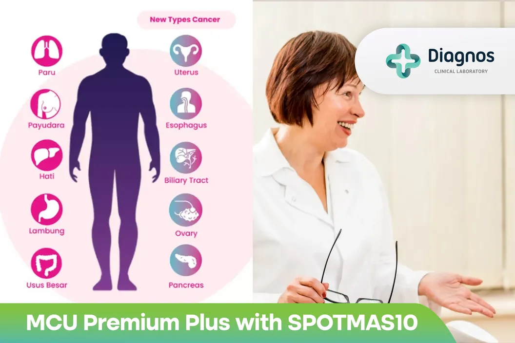 https://img-kd.kalbe.co.id/axQ4wLJE2XwHJNYgzJWWWiQ_AdE=/fit-in/1056x705/filters:quality(90)/oneonco-prd/product/Diagnos%20-%20MCU%20Premium%20Plus%20with%20SPOTMAS10_1762833889.webp