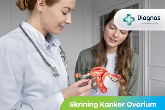 Skrining Kanker Ovarium