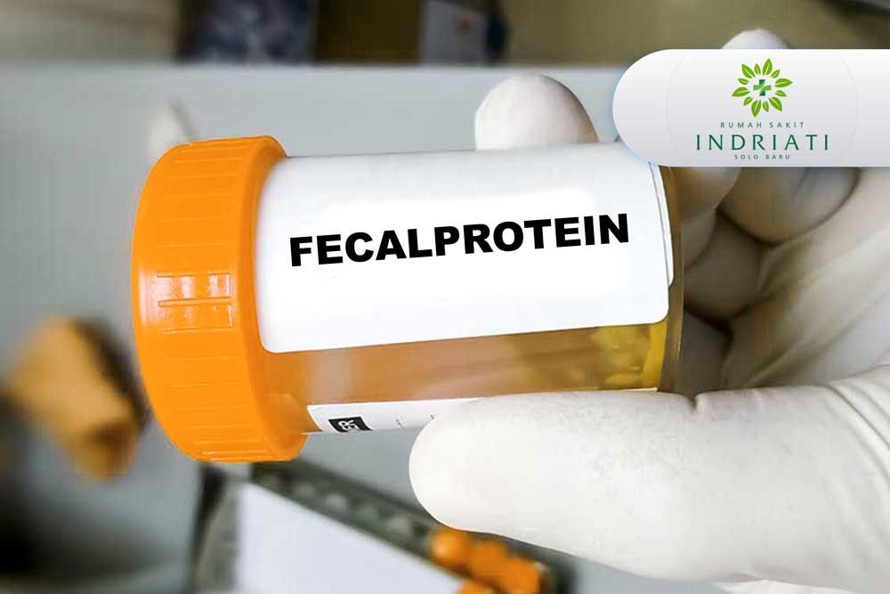 https://img-kd.kalbe.co.id/cRcNIp6IQQEr7X-sxCosRQKNhmk=/fit-in/1056x705/filters:quality(90)/oneonco-prd/product/FECALPROTEIN-indriati_1672393169.jpg