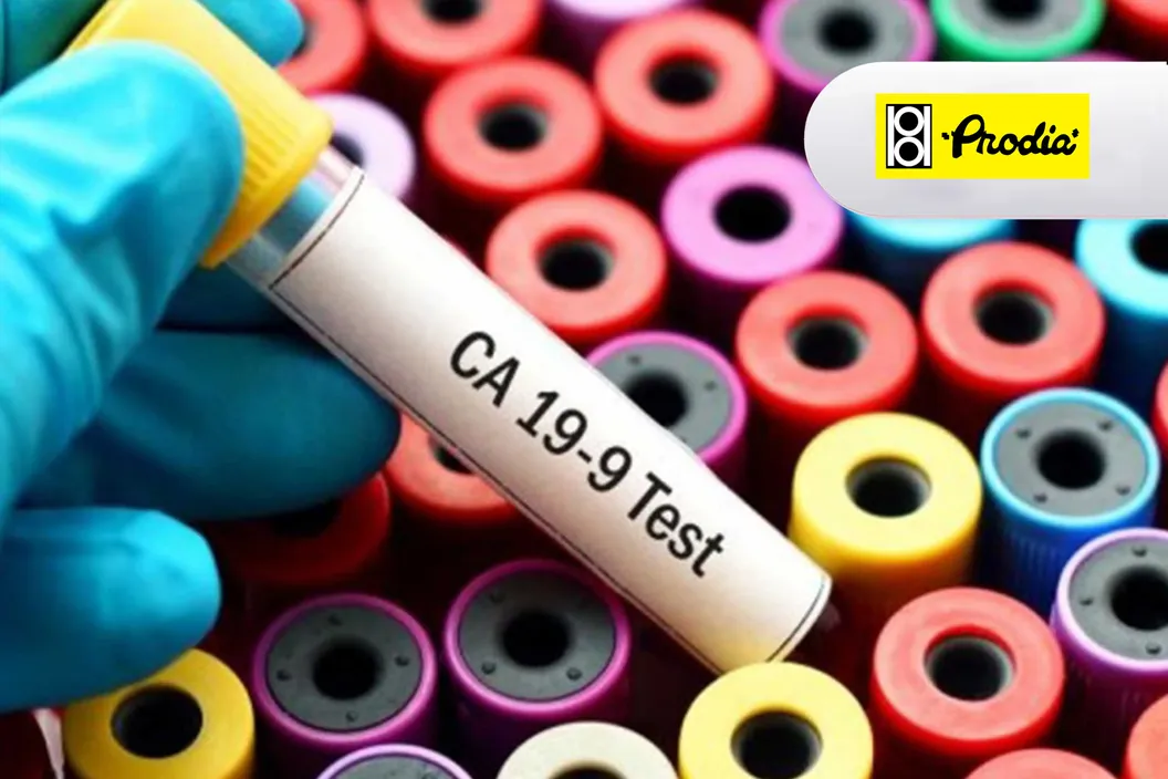 https://img-kd.kalbe.co.id/cusXwMOOiQf-W-rjA-WTUY9nuXE=/fit-in/1056x705/filters:quality(90)/oneonco-prd/product%2FProdia-CA%2019-9_1738314316.webp