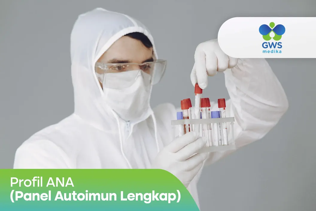 https://img-kd.kalbe.co.id/e-9EDlgPQ9QWOFzqall06vm-Kho=/fit-in/1056x705/filters:quality(90)/oneonco-prd/product/Klinik%20GWS%20Medika%20-%20Profil%20ANA%20IF%20-%20Panel%20Autoimun%20Lengkap_1754638529.webp