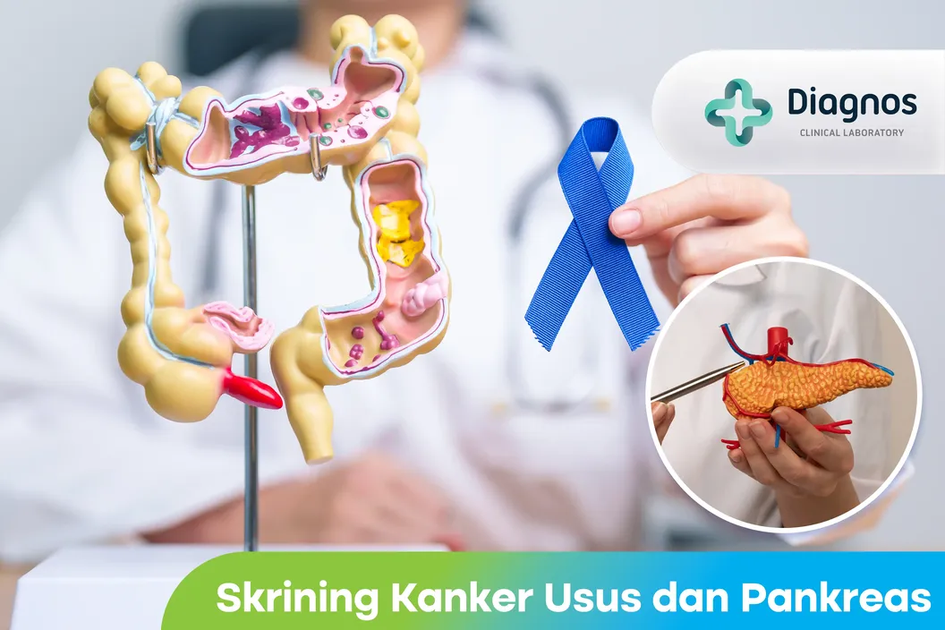 https://img-kd.kalbe.co.id/e_e8mOY7c5AOng1Zq8ARBRhK8ho=/fit-in/1056x705/filters:quality(90)/oneonco-prd/product/Laboratorium%20Diagnos%20-%20Skrining%20Kanker%20Usus%20dan%20Pankreas_1758941107.webp