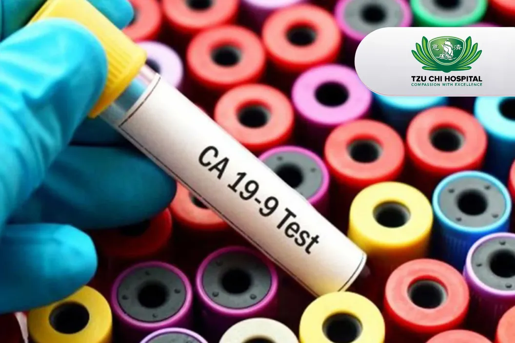 https://img-kd.kalbe.co.id/kSItAhIVoW115JEJIfFzeLrw8bE=/fit-in/1056x705/filters:quality(90)/oneonco-prd/product%2FCA%2019-9%20-%20tzu%20chi_1749097000.webp