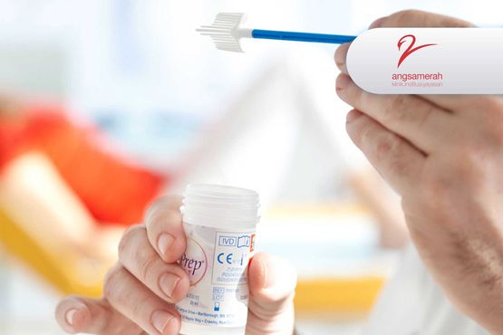HPV DNA Genotyping dan LBC (Thinprep)