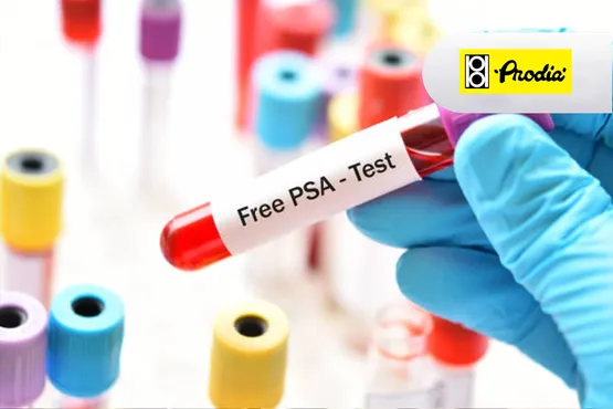 Free PSA