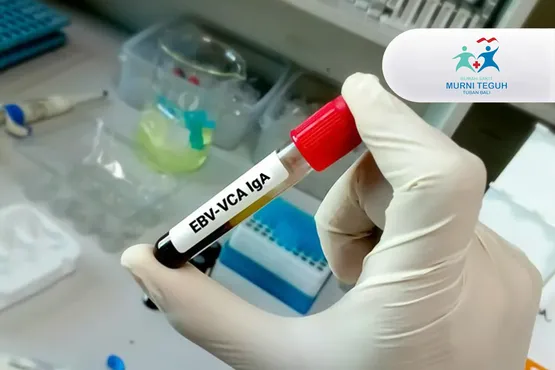 Tes EBV DNA
