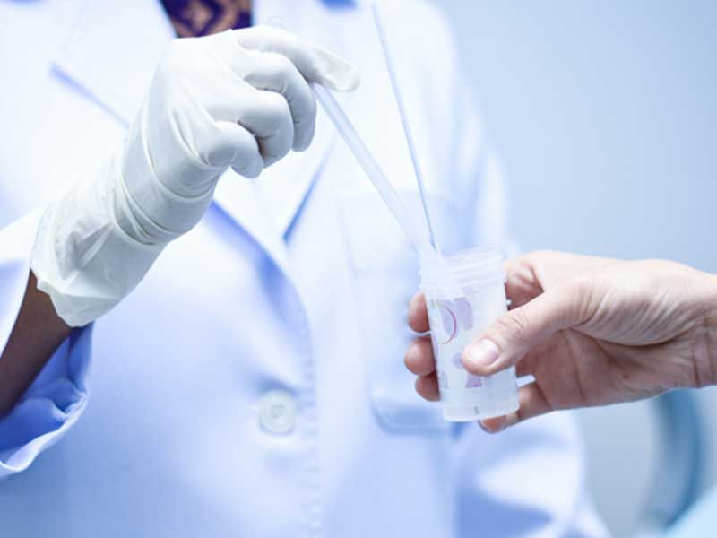 HPV DNA