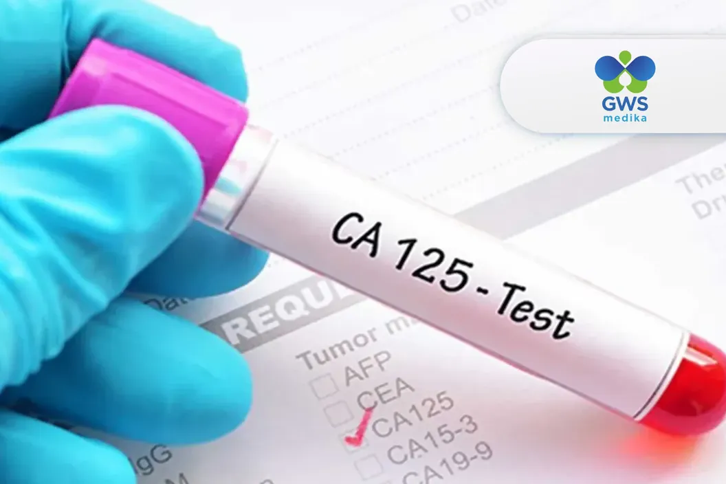 https://img-kd.kalbe.co.id/p_Ds74z7w8AF-nlDoOoDlHlYDYw=/fit-in/1056x705/filters:quality(90)/oneonco-prd/product/Klinik%20GWS%20Medika%20-%20CA-125%20Test_1754876171.webp