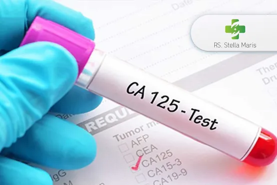 CA-125