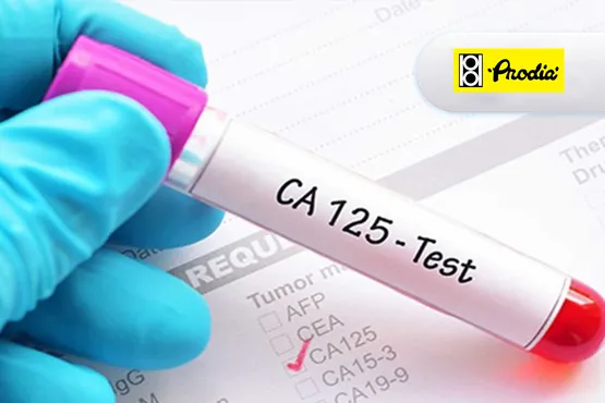 CA125