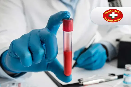 Total PSA (Prostat Specific Antigen)