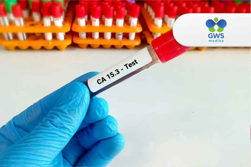 https://img-kd.kalbe.co.id/vF4mRaLkxu26MJg2UcvwoDGLRr8=/fit-in/1056x705/filters:quality(90)/oneonco-prd/product/Klinik%20GWS%20Medika%20-%20CA%2015-3%20Test_1754876534.webp